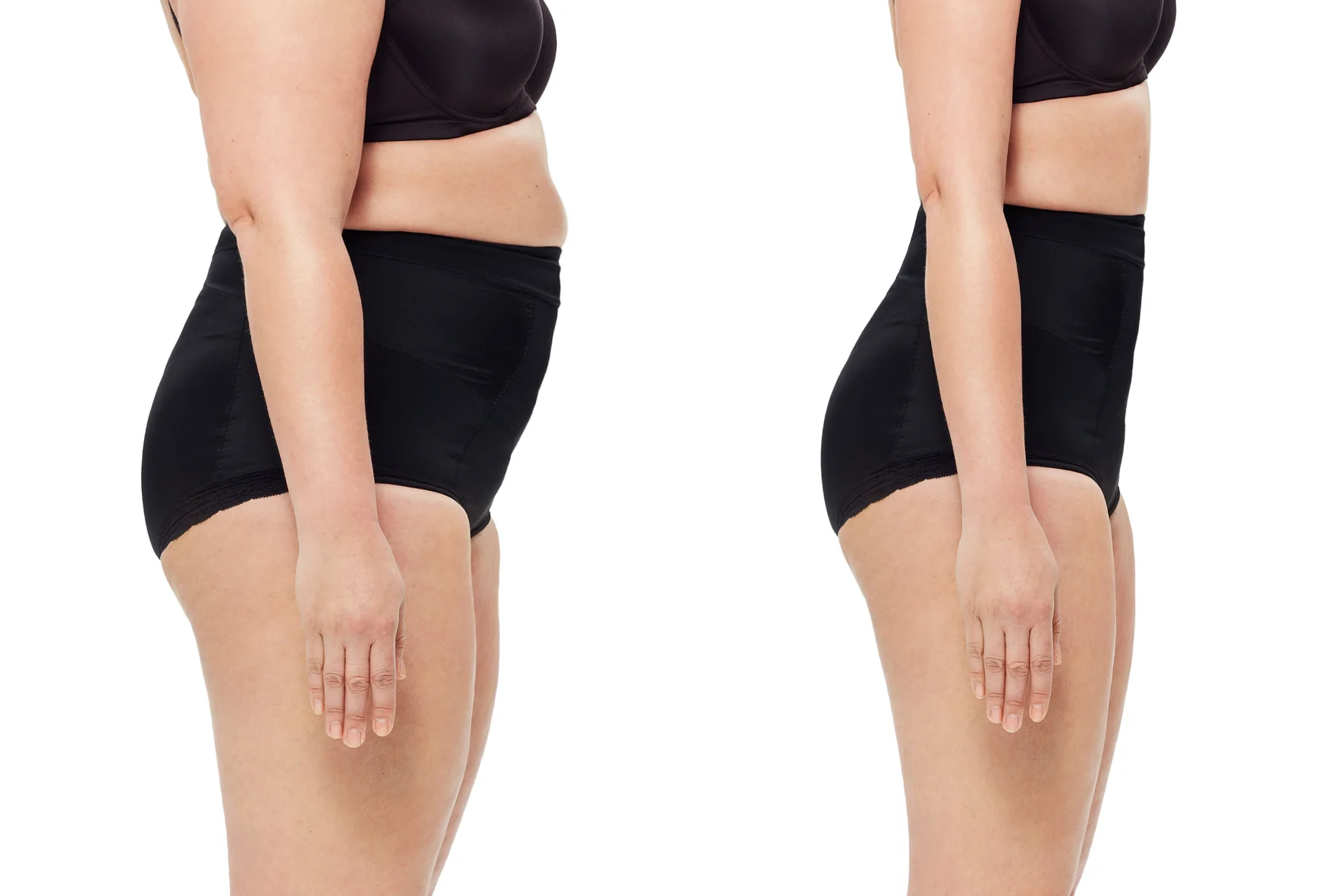 Semaglutide Dosing for Weight Loss (2026 Guide): Starting Dose, Maximum Dose & Weekly Schedule Explained