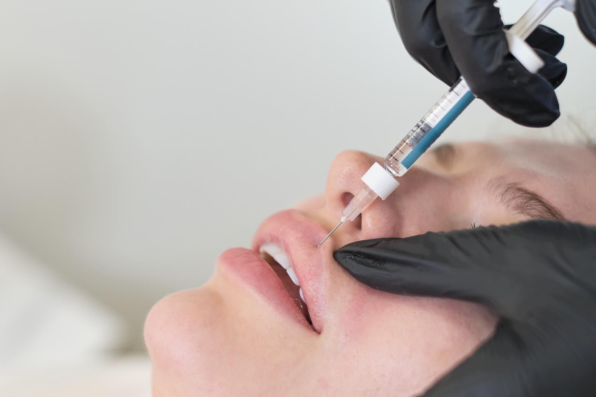 at home fillers