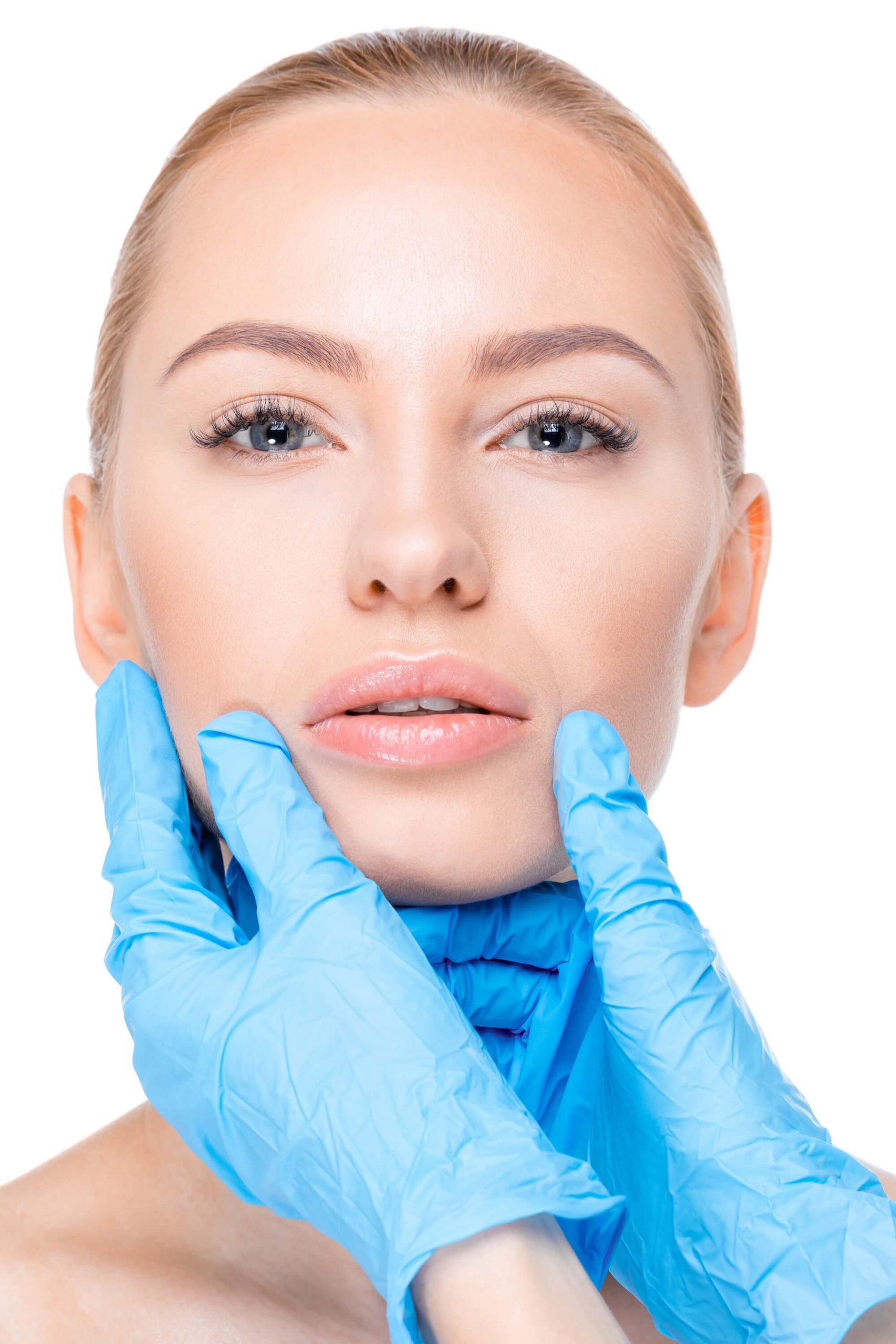 dermal filler vs fat graft
