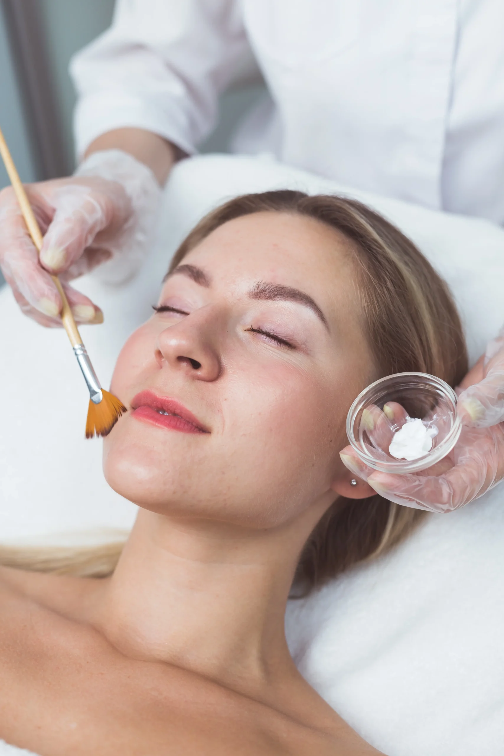 chemical peel cost