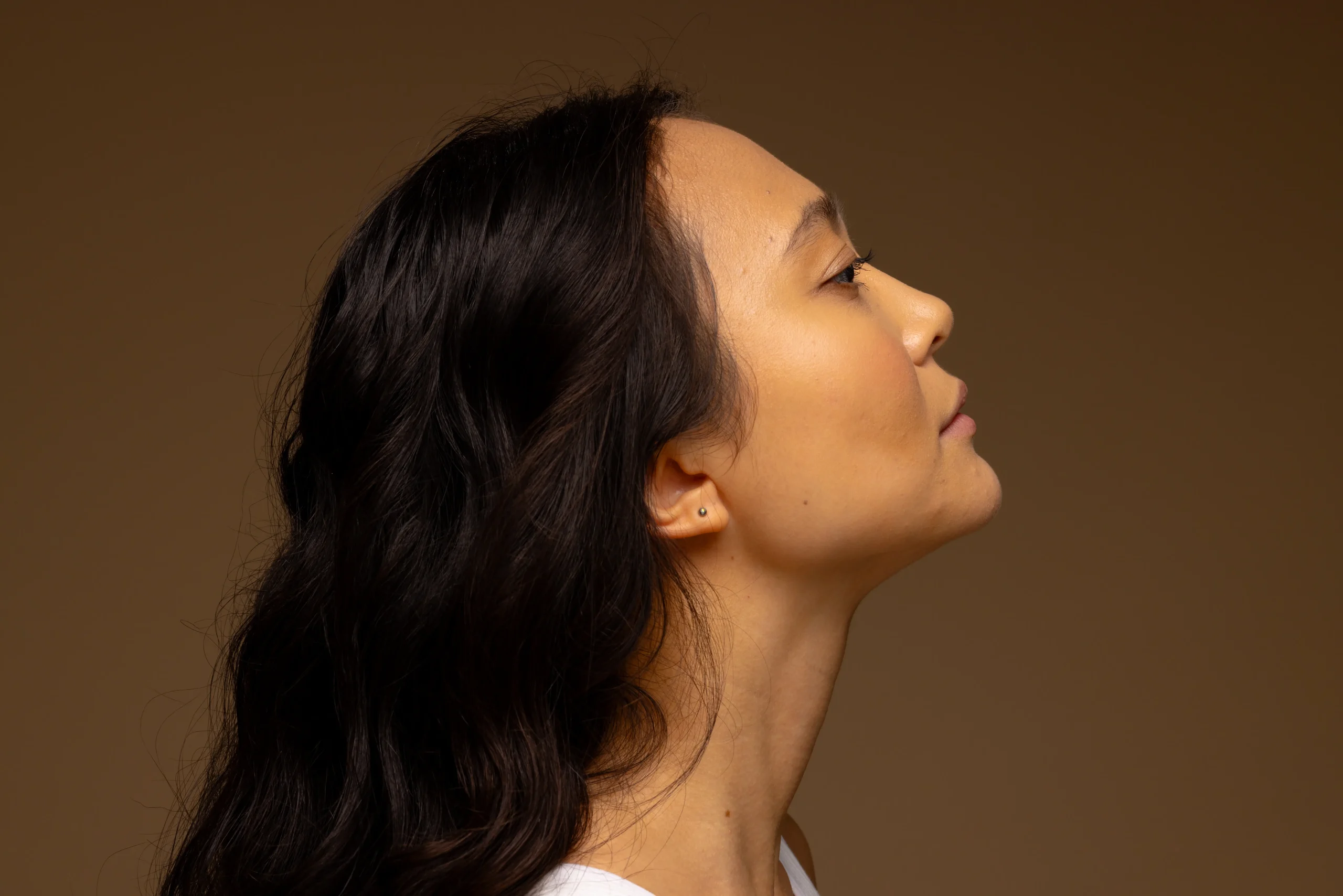 kybella side effects