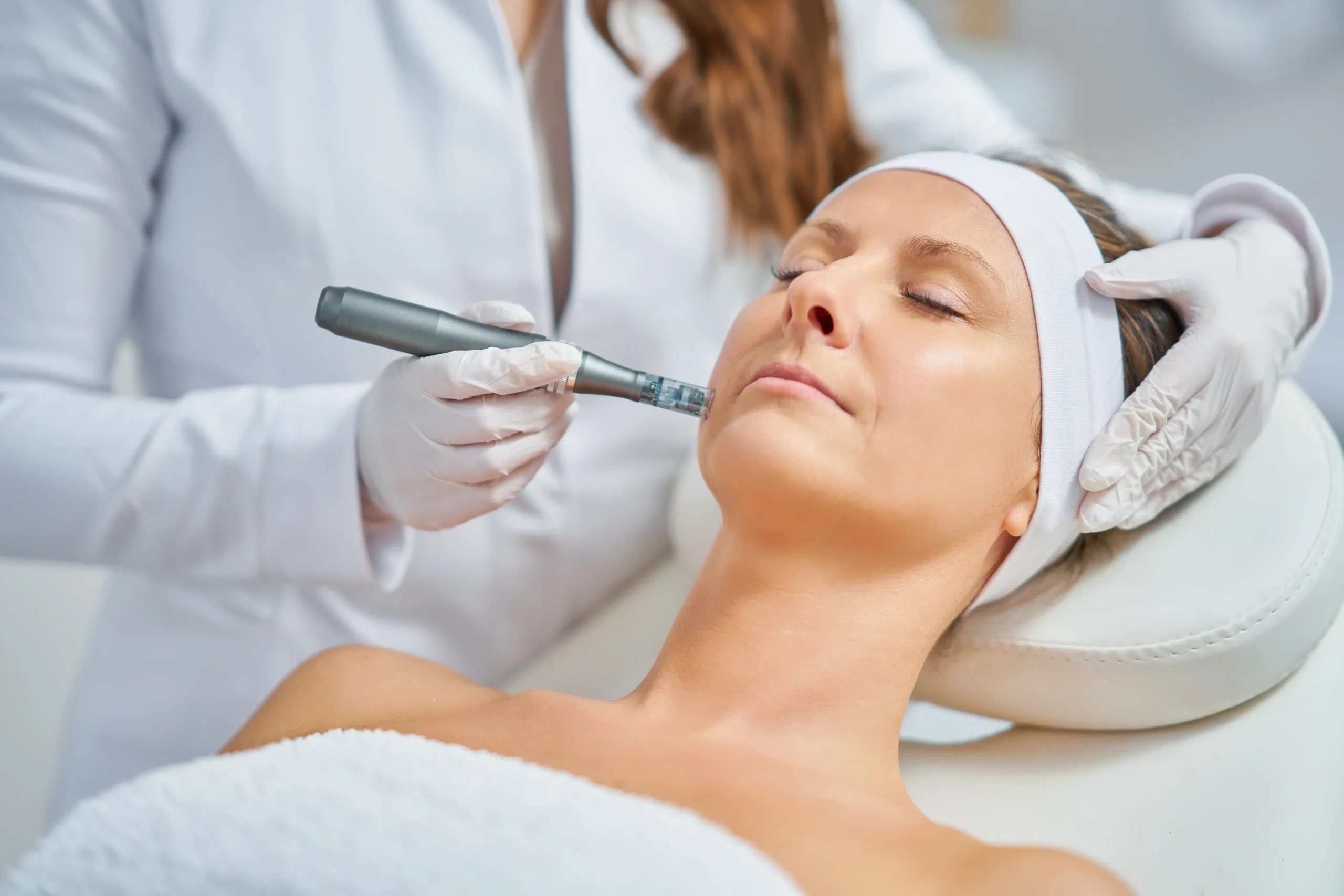 microneedling cost