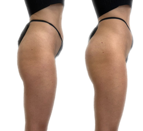 InjectCo offers liquid bbl services in and around Waxahachie