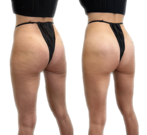 InjectCo offers liquid bbl services in and around Plano