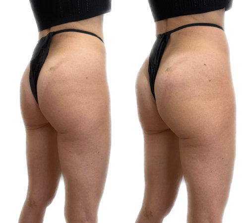 InjectCo offers liquid bbl services in and around Fort Worth