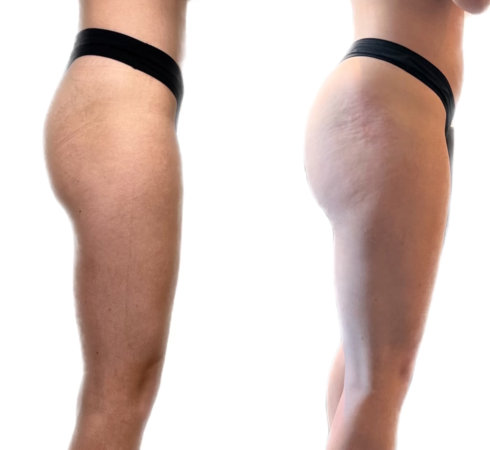 InjectCo offers liquid bbl services in and around Colleyville