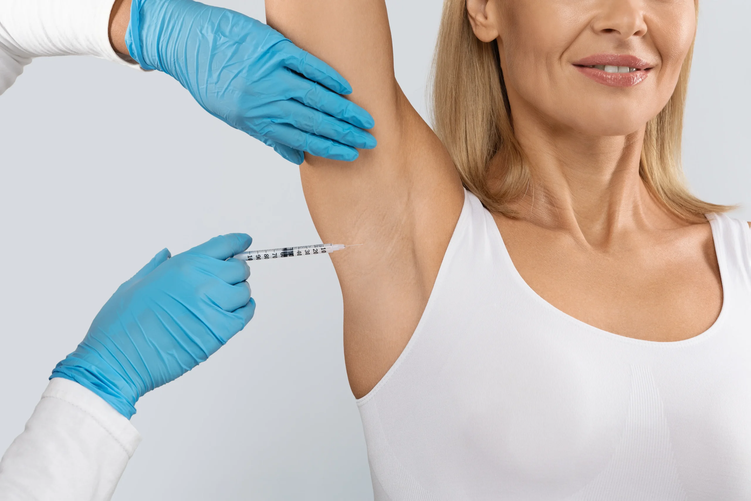 botox for underarms reviews