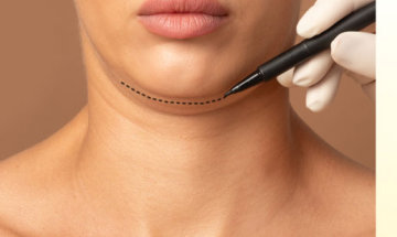 Young woman getting Botox services for jaw slimming at InjectCo's med in woodland.