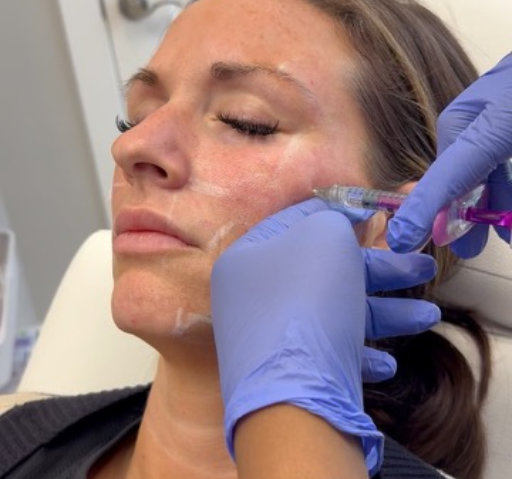 Young woman getting botox services at InjectCo's med in woodland.