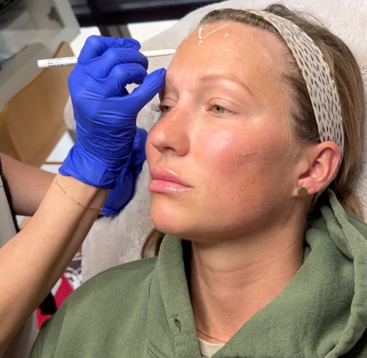 Young woman getting Botox services for jaw slimming and TMJ relief at InjectCo's med spa in The Woodlands.