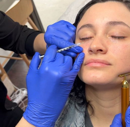 Close-up of a young woman receiving a precise Botox treatment for crow's feet at InjectCo's med spa in The Woodlands.