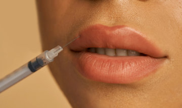 Young woman getting Botox services for a lip flip at InjectCo's med in woodland.