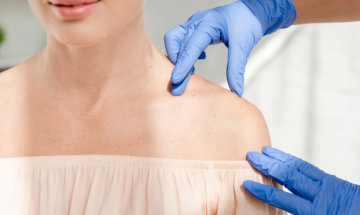 Young woman getting shoulder botox services at InjectCo’s med spa in The Woodlands.