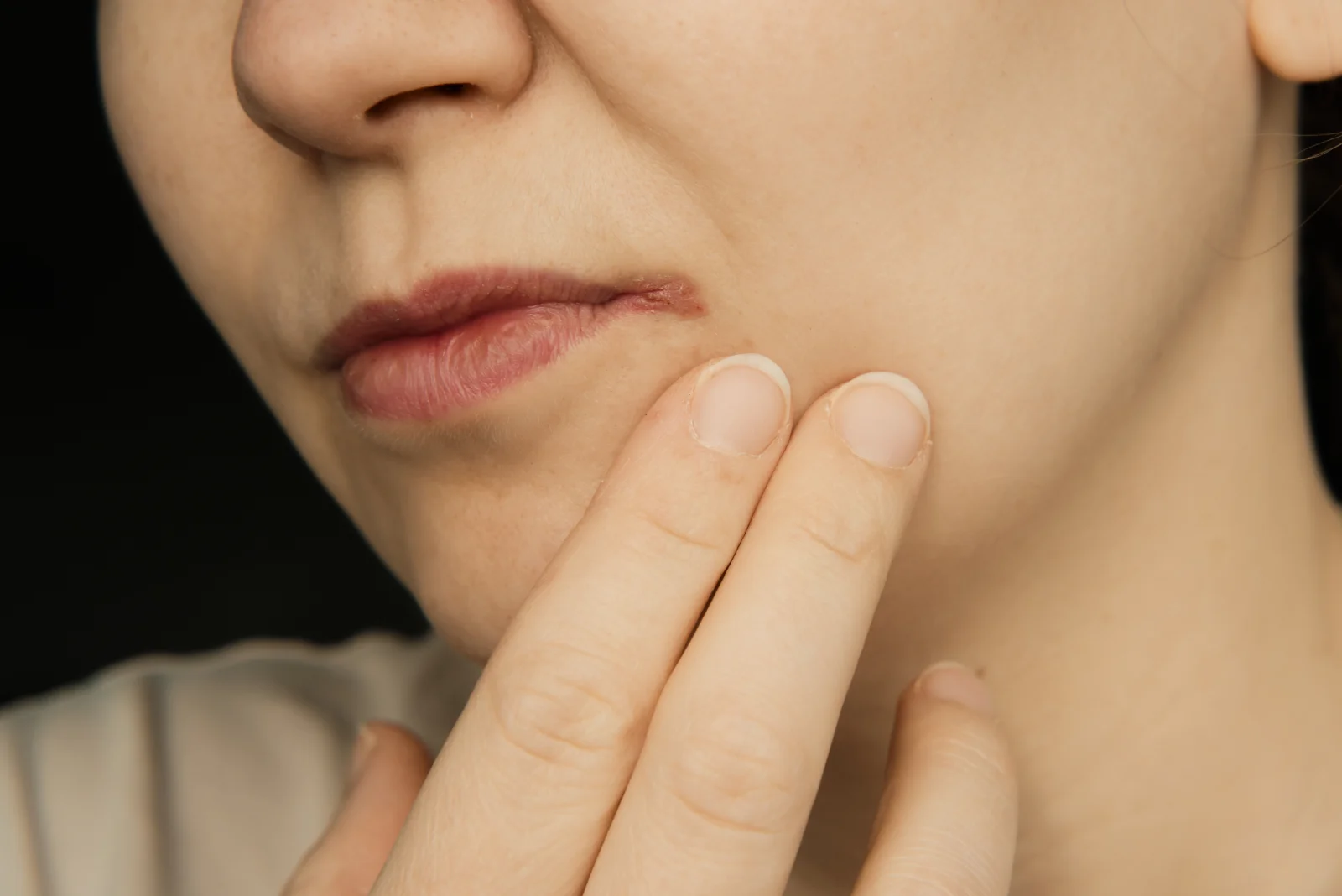 Laser Hair Removal for PCOS Facial Hair: How It Works, What to Expect