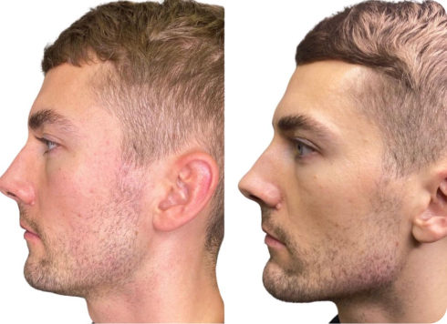 male jawline