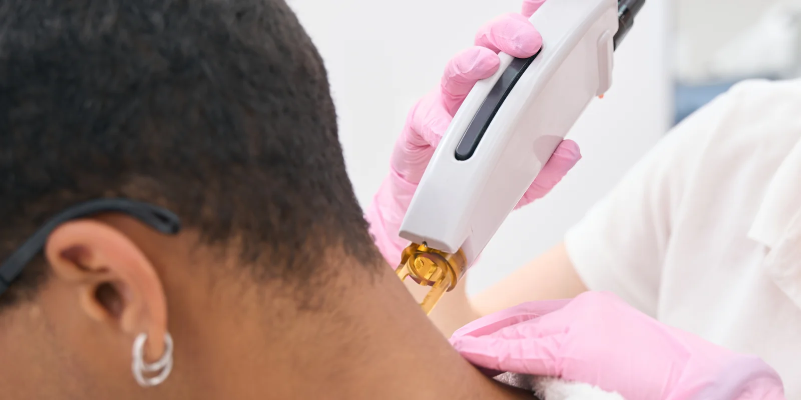 Neck Laser Hair Removal for Men: Permanent Solution to Razor Bumps