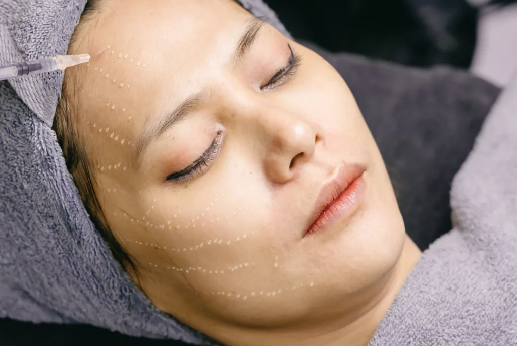 Woman considering a PDO thread lift consultation at an InjectCo med spa in Texas