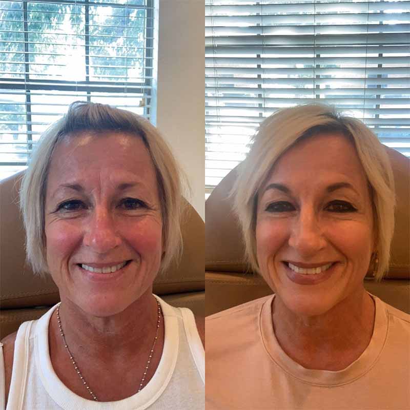 Best med spas Arlington TX comparison 2026