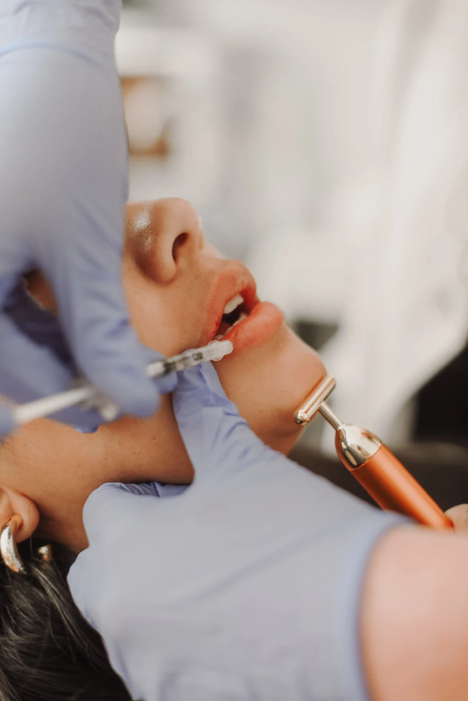 Dermal filler treatment using a cannula Nurse injector performing a dermal filler treatment using a cannula