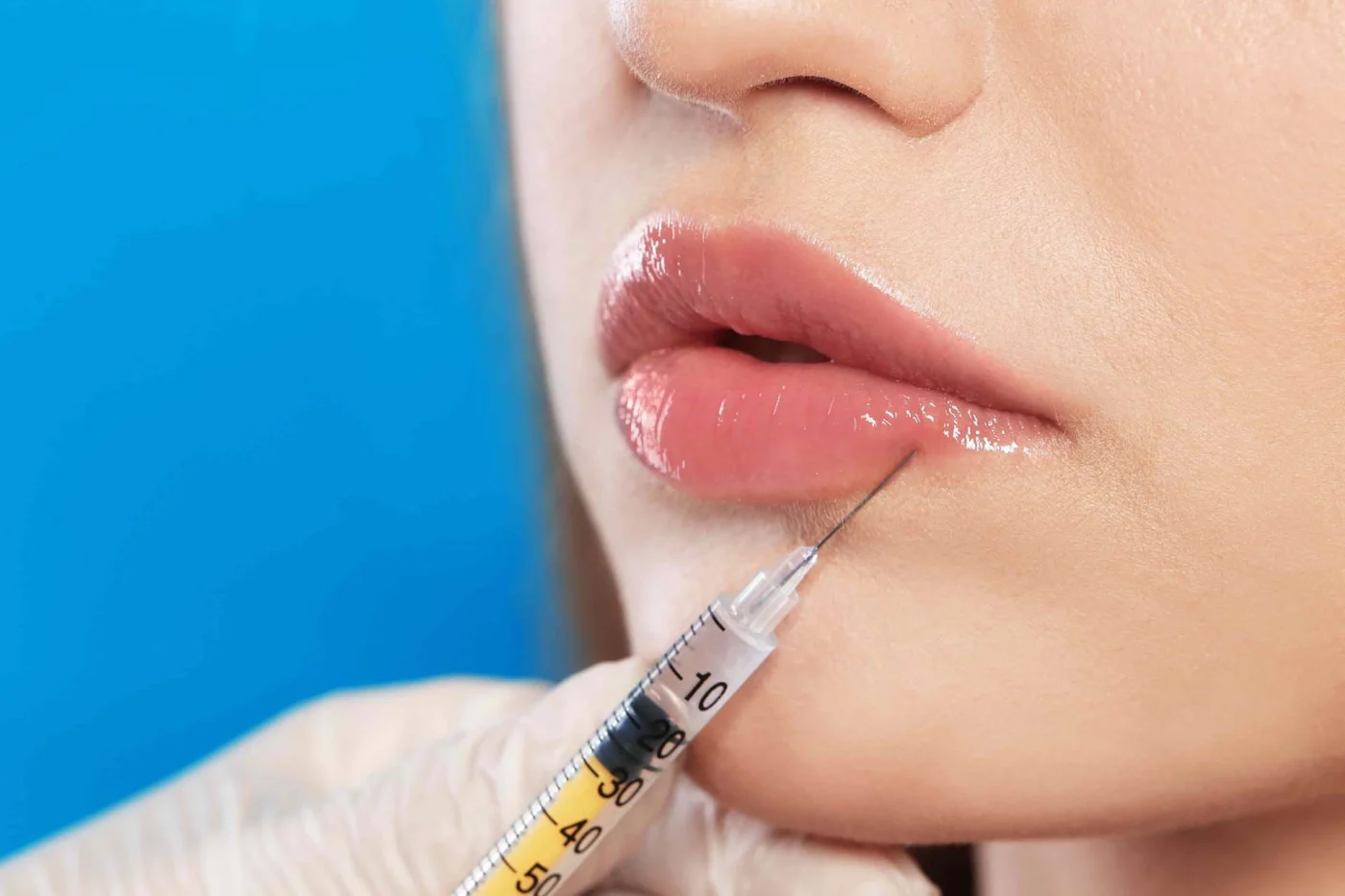 Lip filler cost and payment plan options at InjectCo MedSpa Patient reviewing lip filler pricing and payment plan options at a consultation