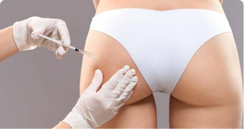 Gloved nurse injector placing product in the buttock during a non-surgical liquid BBL
